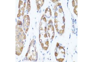 Immunohistochemistry (Paraffin-embedded Sections) (IHC (p)) image for anti-ATG5 Autophagy Related 5 (ATG5) (AA 1-275) antibody (ABIN3020674)