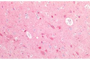 Detection of UBQLN2 in Human Brain Tissue using Polyclonal Antibody to Ubiquilin 2 (UBQLN2) (Ubiquilin 2 Antikörper  (AA 33-126))