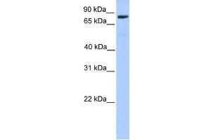 C12ORF40 antibody used at 1 ug/ml to detect target protein. (C12orf40 Antikörper  (N-Term))