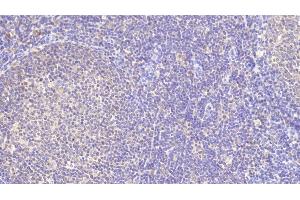 Detection of TFR in Porcine Lymph node Tissue using Polyclonal Antibody to Transferrin Receptor (TFR) (Transferrin Receptor Antikörper  (AA 578-765))