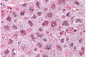 Human Liver (formalin-fixed, paraffin-embedded) stained with CAT antibody ABIN214024 at 5 ug/ml followed by biotinylated goat anti-rabbit IgG secondary antibody ABIN481713, alkaline phosphatase-streptavidin and chromogen. (Catalase Antikörper)