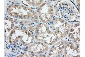 Immunohistochemical staining of paraffin-embedded Human prostate tissue using anti-SNX9 mouse monoclonal antibody. (SNX9 Antikörper)