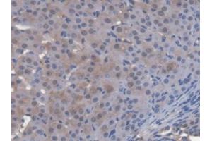 DAB staining on IHC-P; Samples: Mouse Ovary Tissue (ENOX2 Antikörper  (AA 1-207))