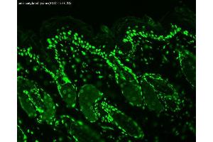 Immunohistochemistry analysis using Mouse Anti-Acetylated Lysine Monoclonal Antibody, Clone 7F8 . (Lysine (lys) (acetylated) Antikörper (Biotin))