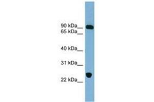 Image no. 1 for anti-Vacuolar Protein Sorting 53 Homolog (VPS53) (AA 431-480) antibody (ABIN6742156)