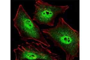 Fluorescent image of A549 cells stained with SIRT1 antibody.