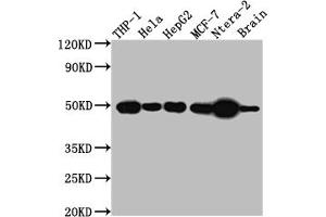 Western Blot Positive WB detected in: THP-1 whole cell lysate, Hela whole cell lysate, HepG2 whole cell lysate, MCF-7 whole cell lysate, Ntera-2 whole cell lysate, Mouse Brain whole cell lysate All lanes: TACR1 antibody at 1:1000 Secondary Goat polyclonal to rabbit IgG at 1/50000 dilution Predicted band size: 47, 36 kDa Observed band size: 50 kDa (Rekombinanter TACR1 Antikörper)