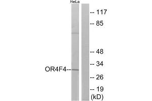 Western blot analysis of extracts from HeLa cells, using OR4F4 antibody. (OR4F4 Antikörper  (C-Term))