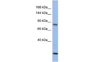 WB Suggested Anti-MAP3K11  Antibody Titration: 0. (MAP3K11 Antikörper  (Middle Region))