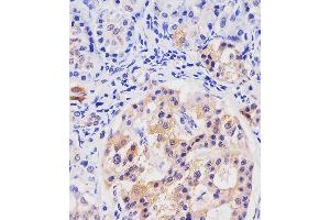 A staining HHLA2 in human pancreas tissue sections by Immunohistochemistry (IHC-P - paraformaldehyde-fixed, paraffin-embedded sections). (HHLA2 Antikörper  (AA 58-87))