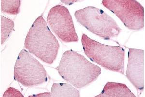 Human Skeletal Muscle (formalin-fixed, paraffin-embedded) stained with CCNL1 antibody ABIN214640 at 10 ug/ml followed by biotinylated goat anti-rabbit IgG secondary antibody ABIN481713, alkaline phosphatase-streptavidin and chromogen. (Cyclin L1 Antikörper)
