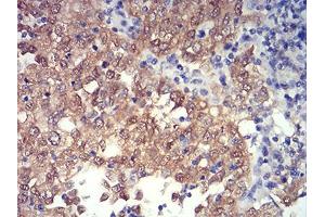 Immunohistochemistry (IHC) image for anti-PR Domain Containing 4 (PRDM4) (AA 476-575) antibody (ABIN5542356)