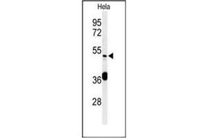 Western blot analysis of DDX49 Antibody (C-term) in Hela cell line lysates (35ug/lane). (DDX49 Antikörper  (C-Term))
