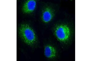 Immunofluorescent analysis of 4 % paraformaldehyde-fixed, 0. (FADS2 Antikörper)