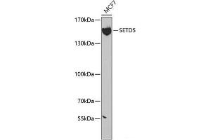 Western blot analysis of extracts of MCF-7 cells using SETD5 Polyclonal Antibody at dilution of 1:300. (SETD5 Antikörper)