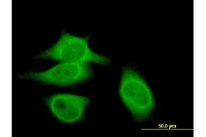 Immunofluorescence of purified MaxPab antibody to CAST on HeLa cell.