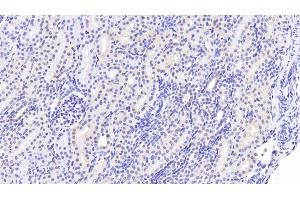Detection of WWP2 in Human Kidney Tissue using Polyclonal Antibody to WW Domain Containing E3 Ubiquitin Protein Ligase 2 (WWP2) (WWP2 Antikörper  (AA 601-870))