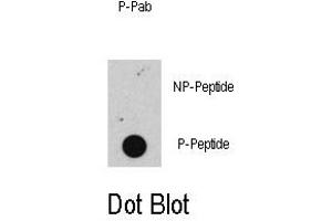 Image no. 1 for anti-Retinoblastoma 1 (RB1) (pSer608) antibody (ABIN358211) (Retinoblastoma 1 Antikörper  (pSer608))