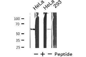 Western blot analysis of extracts from HeLa/293 cells, using STK33 antibody. (STK33 Antikörper  (N-Term))