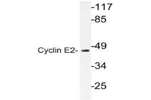 Western blot (WB) analysis of Cyclin E2 antibody in extracts from Jurkat cell. (Cyclin E2 Antikörper)
