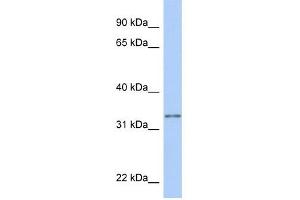 GSTO2 antibody used at 1 ug/ml to detect target protein. (GSTO2 Antikörper  (N-Term))