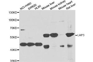 Western blot analysis of extracts of various cell lines, using LAP3 antibody. (LAP3 Antikörper)