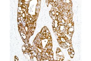 Immunohistochemistry (IHC) image for anti-Keratin 1 (KRT1) antibody (ABIN7449048)