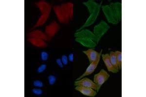 ABIN6258528 and ABIN6274789 staining Hela cells(30 min of UV treatment) by IF/ICC.