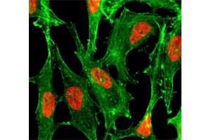 ICC/IF of HeLa cells treated with sodium butyrate, using recombinant H2BK23ac antibody (red).