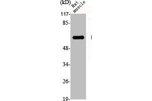 Western Blot analysis of RAT-MUSCLE cells using Dab1 Polyclonal Antibody (DAB1 Antikörper)