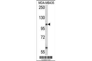 Western blot analysis of CASD1 Antibody in MDA-MB435 cell line lysates (35ug/lane) (CASD1 Antikörper  (N-Term))