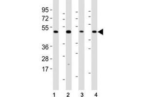 Western Blotting (WB) image for anti-Mixed Lineage Kinase Domain-Like (MLKL) (AA 444-472) antibody (ABIN3028847)