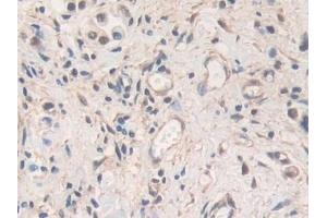 Immunohistochemistry (IHC) image for anti-Matrix Metallopeptidase 19 (MMP19) (AA 98-508) antibody (ABIN7434200)