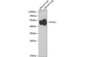 Western blot analysis of extracts of various cell lines using HYAL1 Polyclonal Antibody at dilution of 1:1000. (HYAL1 Antikörper)