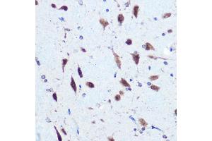 Immunohistochemistry of paraffin-embedded rat brain using hnRNP E2/PCBP2 Rabbit pAb (ABIN3023339, ABIN3023340, ABIN3023341 and ABIN6219620) at dilution of 1:100 (40x lens). (PCBP2 Antikörper  (AA 1-130))