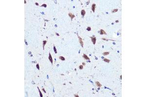 Immunohistochemistry of paraffin-embedded rat brain using hnRNP E2/PCBP2 Rabbit pAb (ABIN3023339, ABIN3023340, ABIN3023341 and ABIN6219620) at dilution of 1:100 (40x lens).