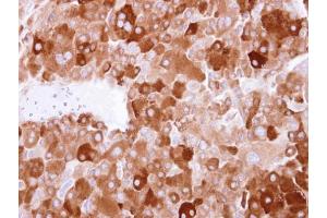 Immunohistochemistry (IHC) image for anti-Latent Transforming Growth Factor beta Binding Protein 4 (LTBP4) (N-Term) antibody (ABIN2855142)