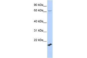 WB Suggested Anti-ZFP37 Antibody Titration:  0. (ZFP37 Antikörper  (Middle Region))