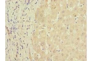 Immunohistochemistry of paraffin-embedded human liver tissue using ABIN7164073 at dilution of 1:100 (PQLC3 Antikörper  (AA 118-170))