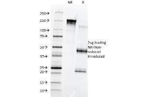 SDS-PAGE Analysis Purified Fibronectin Monoclonal Antibody (568).