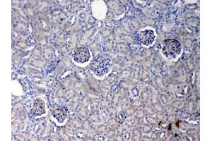 IHC analysis of Crp using anti- Crp antibody . (CRP Antikörper  (AA 20-225))