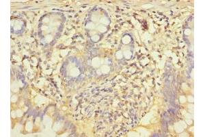 Immunohistochemistry of paraffin-embedded human small intestine tissue using ABIN7148943 at dilution of 1:100 (CCNJL Antikörper  (AA 315-435))