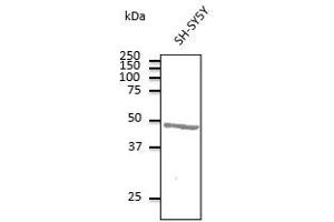 Anti-ATXN3 Ab at 1/500 dilution, Iysates at 100 µg per lane: rabbit polyclonal to goat lgG (HRP) at 1/10,000 dilution, (Ataxin 3 Antikörper  (AA 120-250))