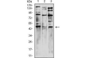 Western Blotting (WB) image for anti-Wilms Tumor 1 (WT1) (AA 1-181) antibody (ABIN7193614)