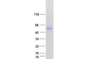 Validation with Western Blot (AADAC Protein (Myc-DYKDDDDK Tag))