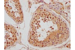 Immunohistochemistry (IHC) image for anti-Leo1, Paf1/RNA Polymerase II Complex Component, Homolog (S. Cerevisiae) (LEO1) (AA 2-24) antibody (ABIN7140122)