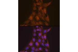 Immunofluorescence analysis of C6 cells using LIS1 Rabbit mAb (ABIN7269401) at dilution of 1:100 (40x lens).