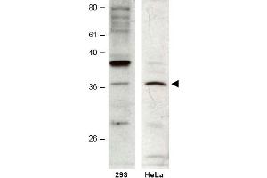 Image no. 1 for anti-HUS1 Checkpoint Homolog B (HUS1B) (AA 104-117) antibody (ABIN401265) (HUS1B Antikörper  (AA 104-117))