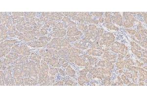 IHC analysis of GLS using anti-GLS antibody (ABIN7601603).