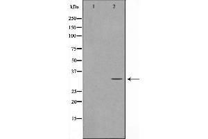 Western blot analysis on Jurkat cell lysate using MAST4 Antibody，The lane on the left is treated with the antigen-specific peptide. (MAST4 Antikörper  (N-Term))